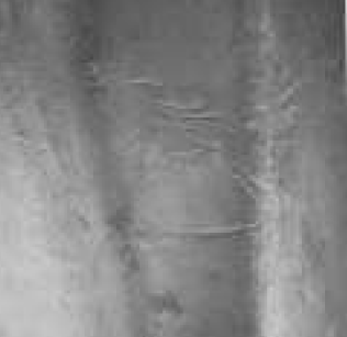 aldc surface defect 02